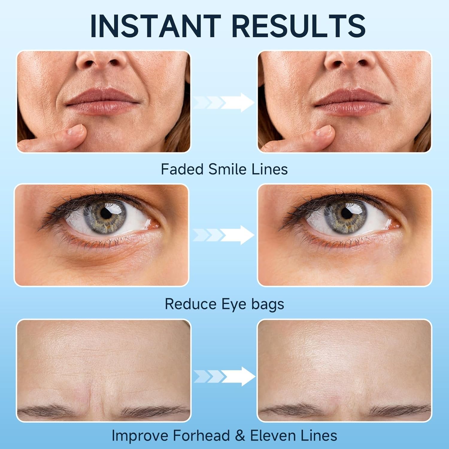 Loreviya Under Eye Cream – Retinol Eye Treatment for Dark Circles & Puffiness, 15ml