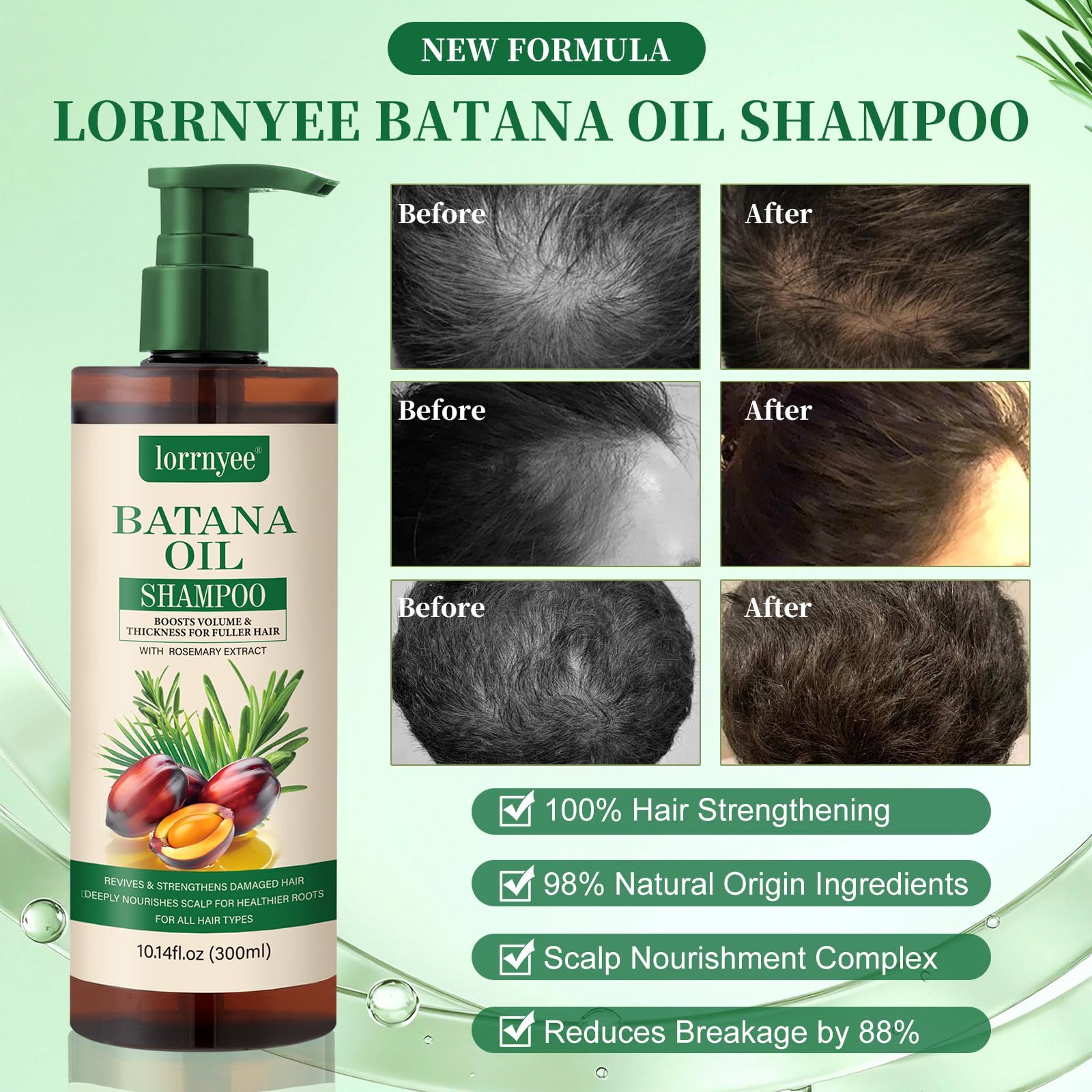 Batana Oil Shampoo for Hair Growth – Lorrnyee with Rosemary, Biotin & Keratin
