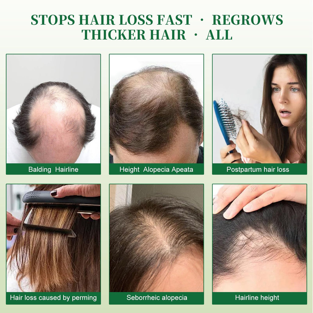 Batana Oil Shampoo for Hair Growth – Lorrnyee with Rosemary, Biotin & Keratin