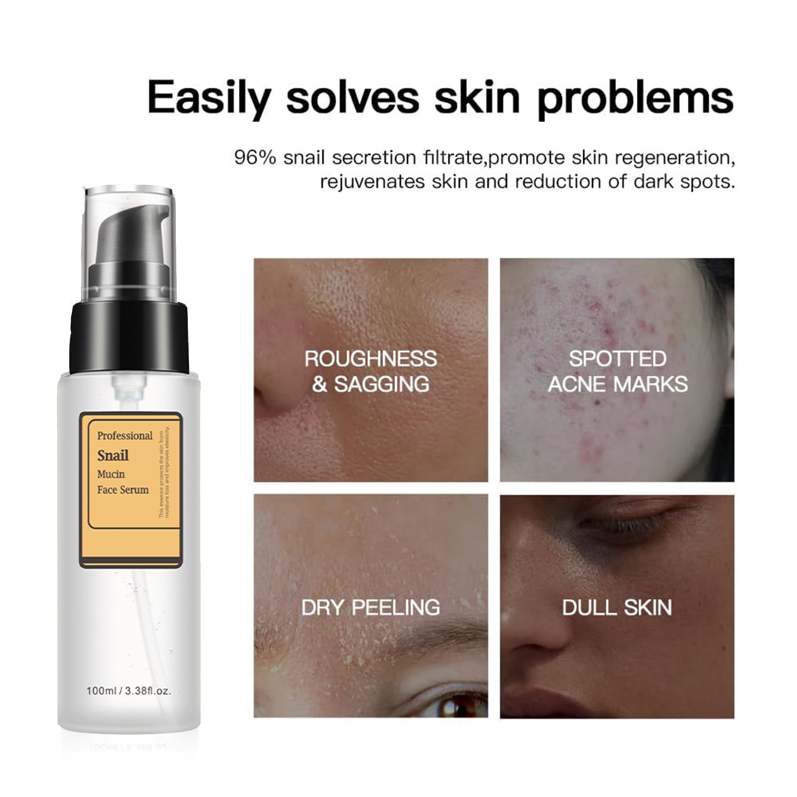Loske Snail Mucin Serum – Hydration, Gentle Repair & Versatile Care