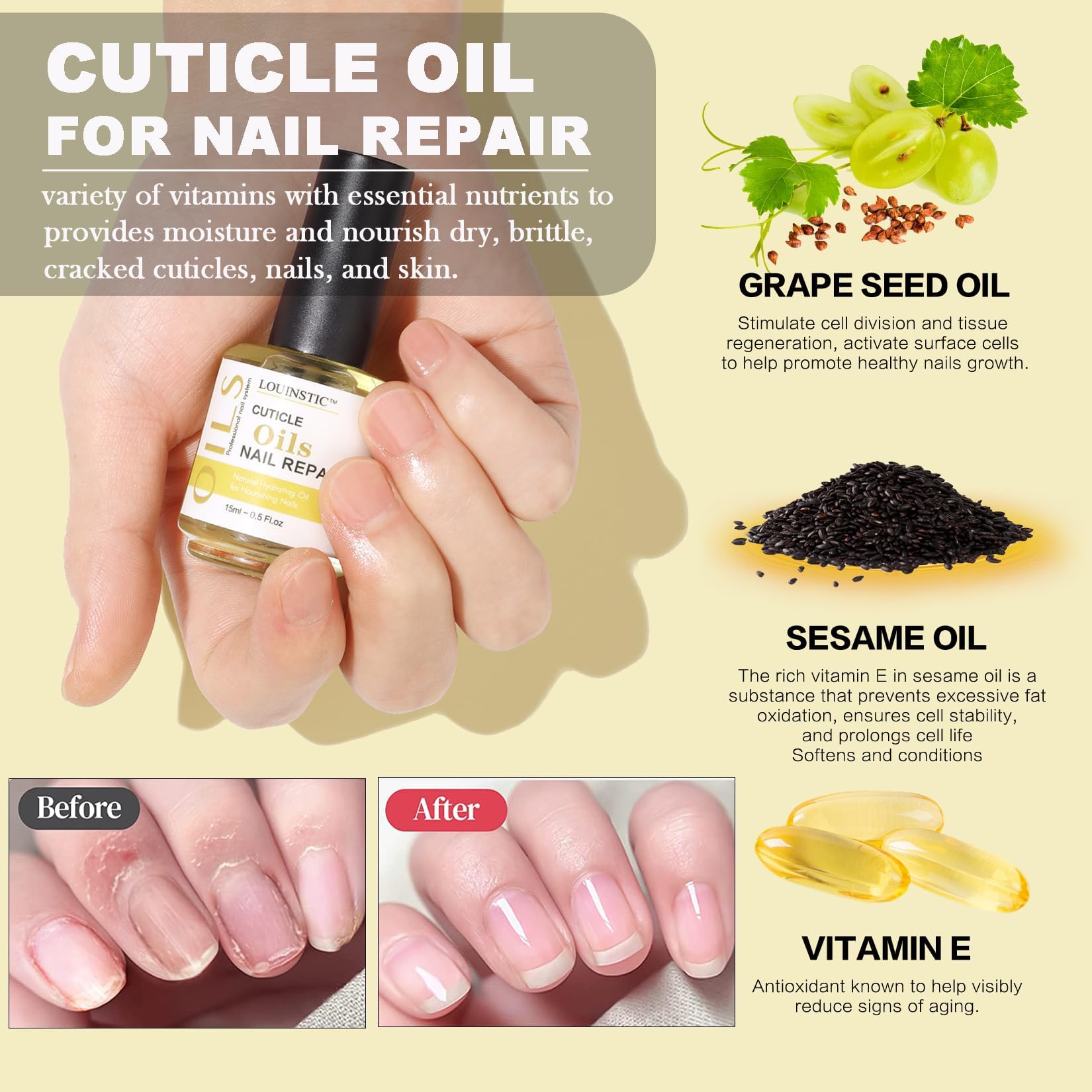 LOUINSTIC Gel Nail Remover & Cuticle Oil Kit – Quick 2–5 Min Gel Polish Removal, No Foil, Low Odor