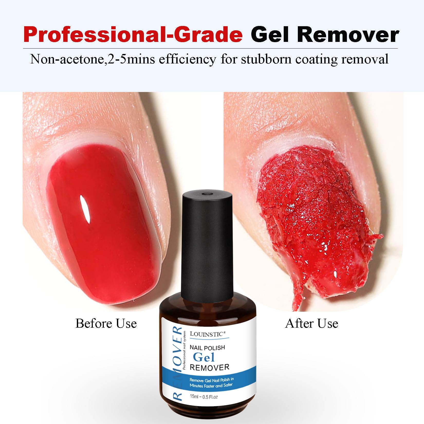 LOUINSTIC Gel Nail Polish Remover Kit – 2pcs Removers, Nail Pusher & Scraper, 2 Files, Quick 2–5 Minute Home Removal