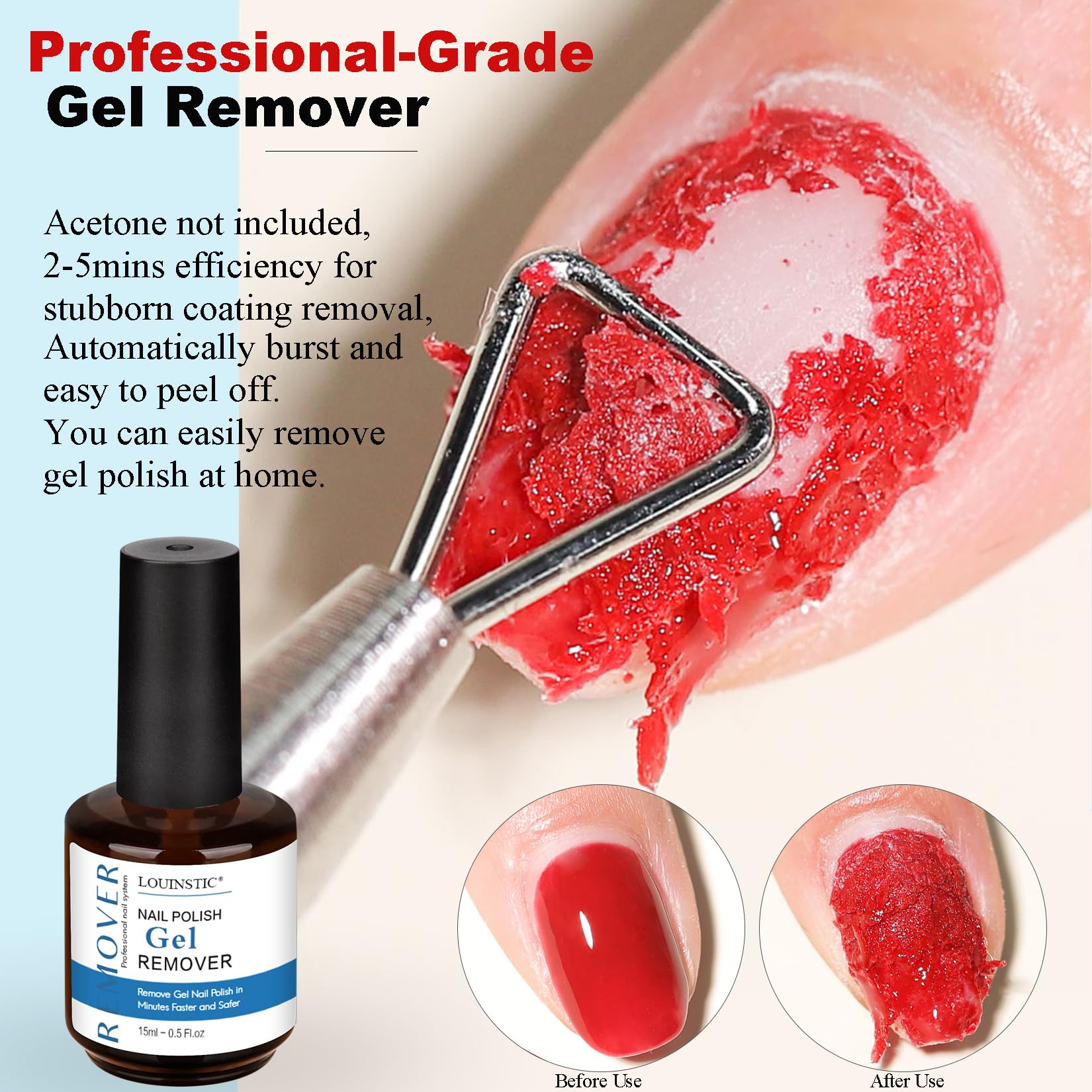 LOUINSTIC Gel Nail Polish Remover Kit – 2pcs Removers, Nail Pusher & Scraper, 2 Files, Quick 2–5 Minute Home Removal