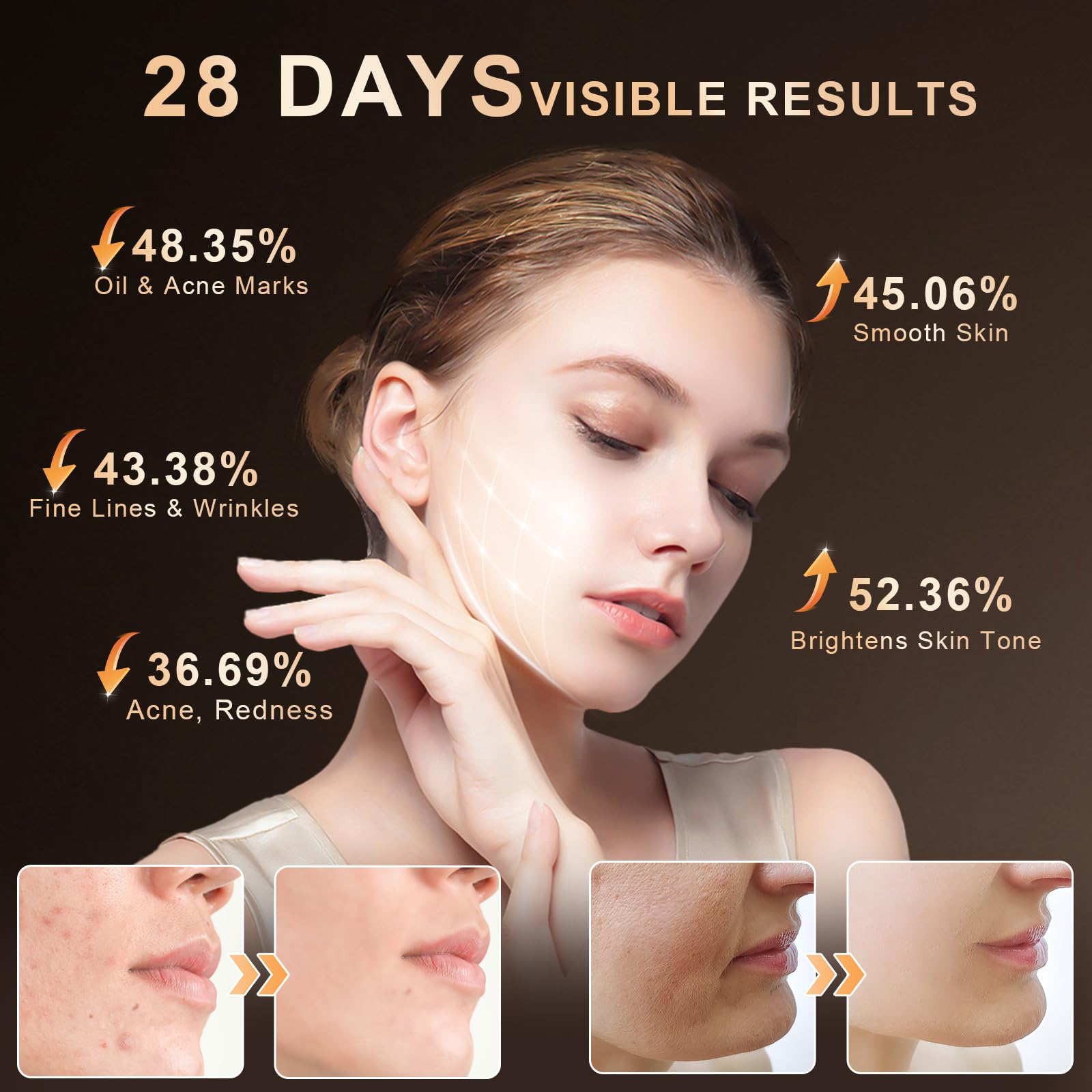 Lovsheme LED Face Mask Light Therapy – Home Professional Skincare with 3 Light Modes
