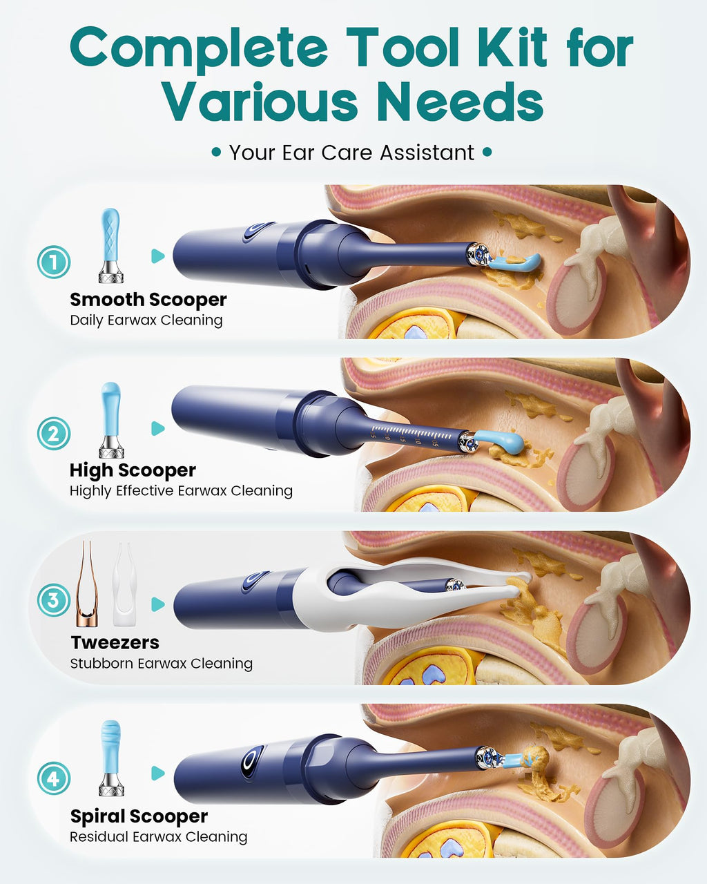 Loyker Ear Wax Removal Kit with 1080P Camera – Visual Ear Cleaner (12 Tips)