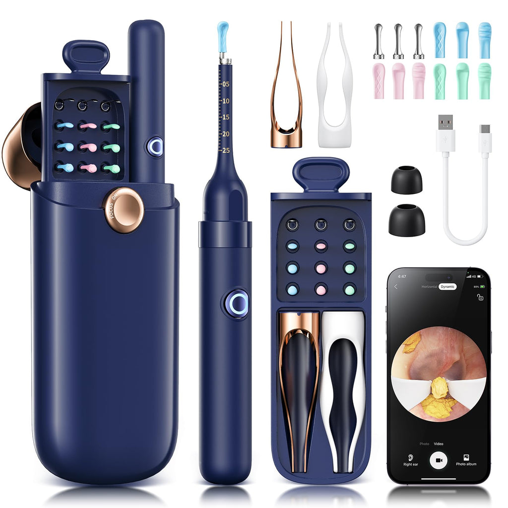 Loyker Ear Wax Removal Kit with 1080P Camera – Visual Ear Cleaner (12 Tips)