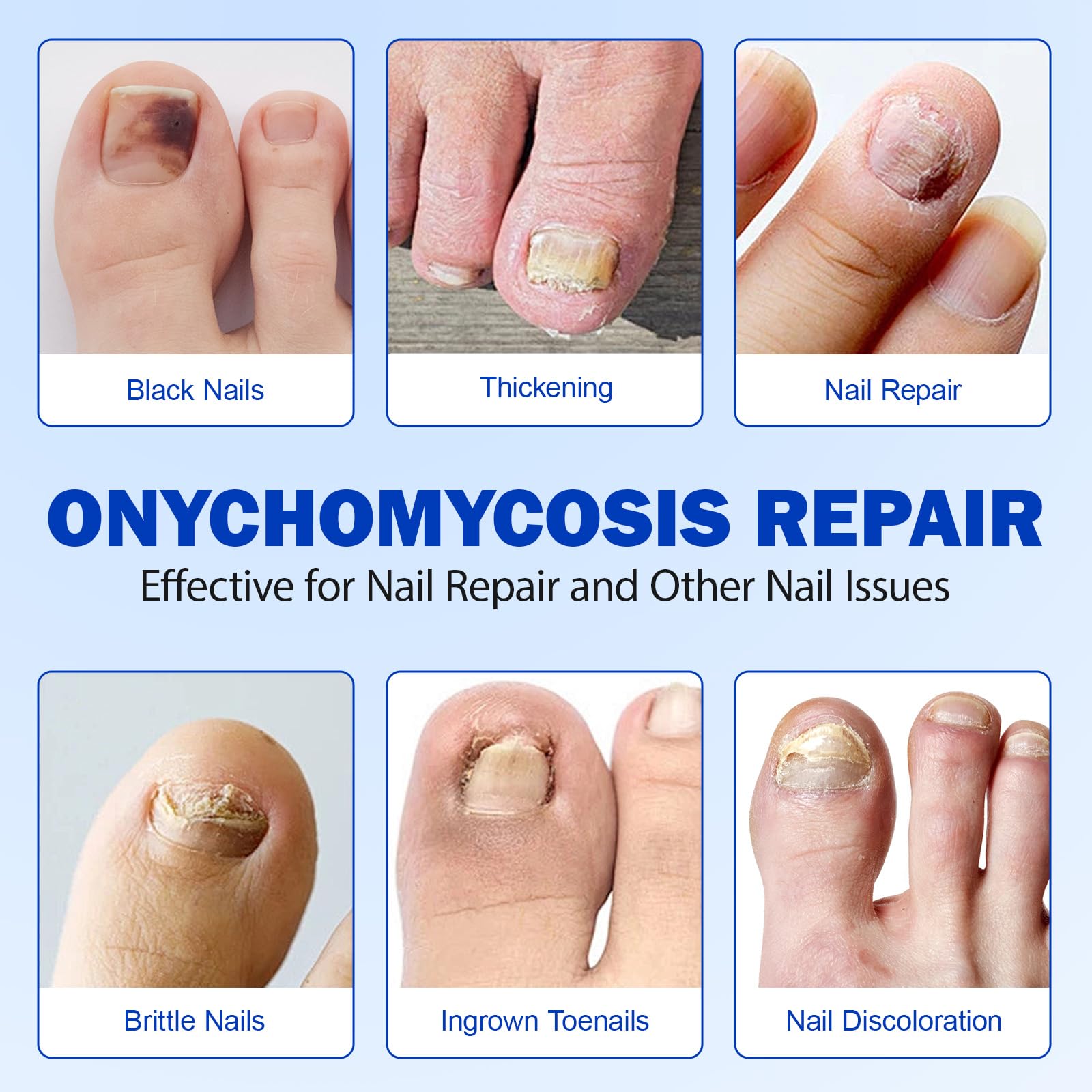 LTQXGT Fungal Nail Patches 2Pack – Extra Strength Toenail Repair