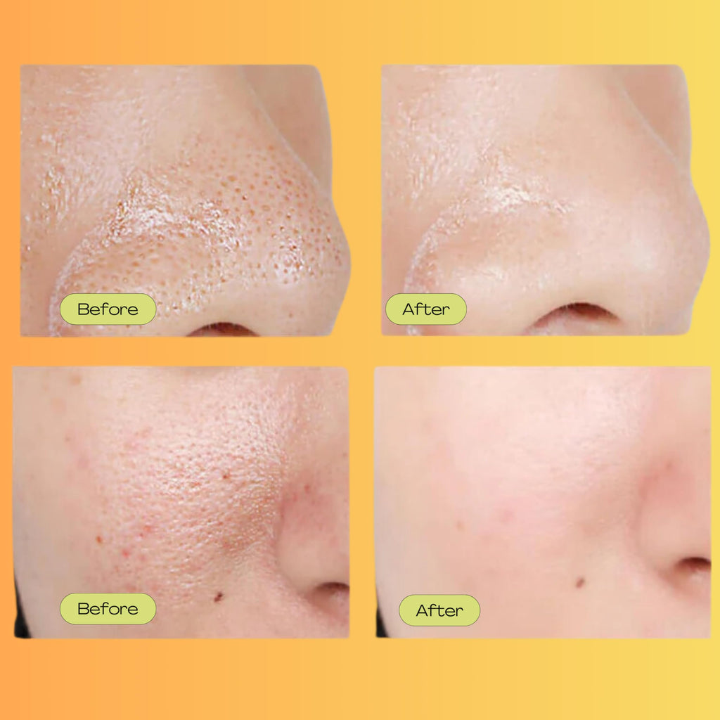 Luelle Pore Minimizer – Lightweight Facial Essence for Pore Refinement and Oil Control