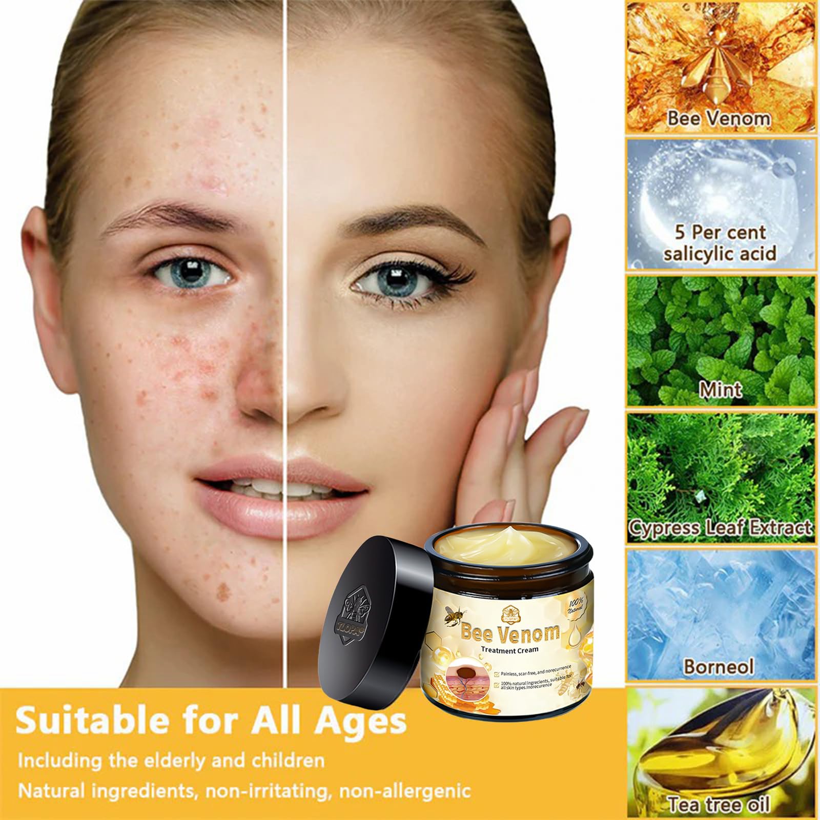 Luhaka Bee Venom Skin Cream – Deep Moisturizing Treatment for Blemish-Prone Skin