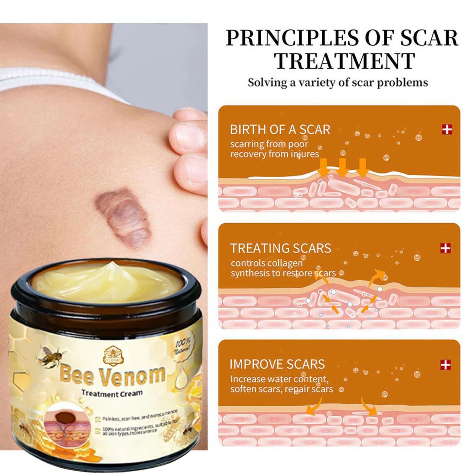 Luhaka Bee Venom Skin Cream – Deep Moisturizing Treatment for Blemish-Prone Skin