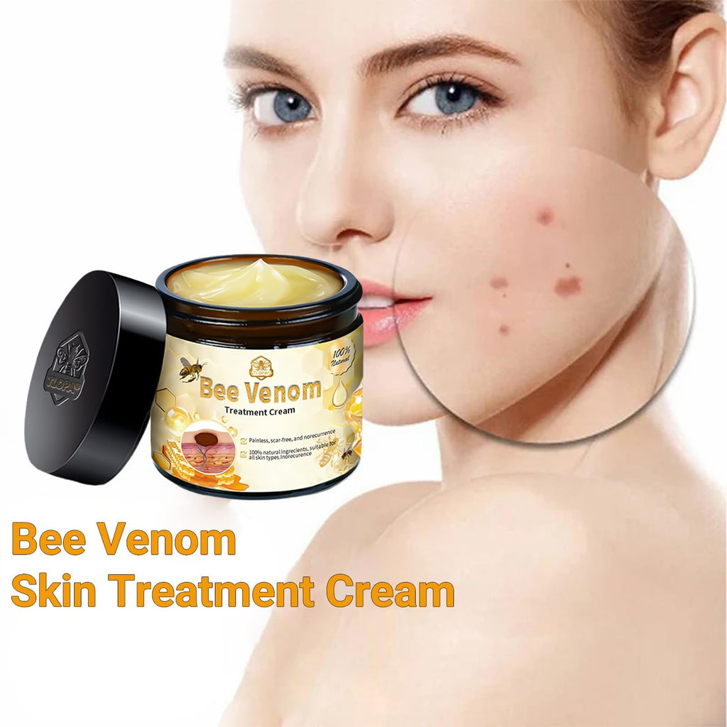 Luhaka Bee Venom Skin Cream – Deep Moisturizing Treatment for Blemish-Prone Skin