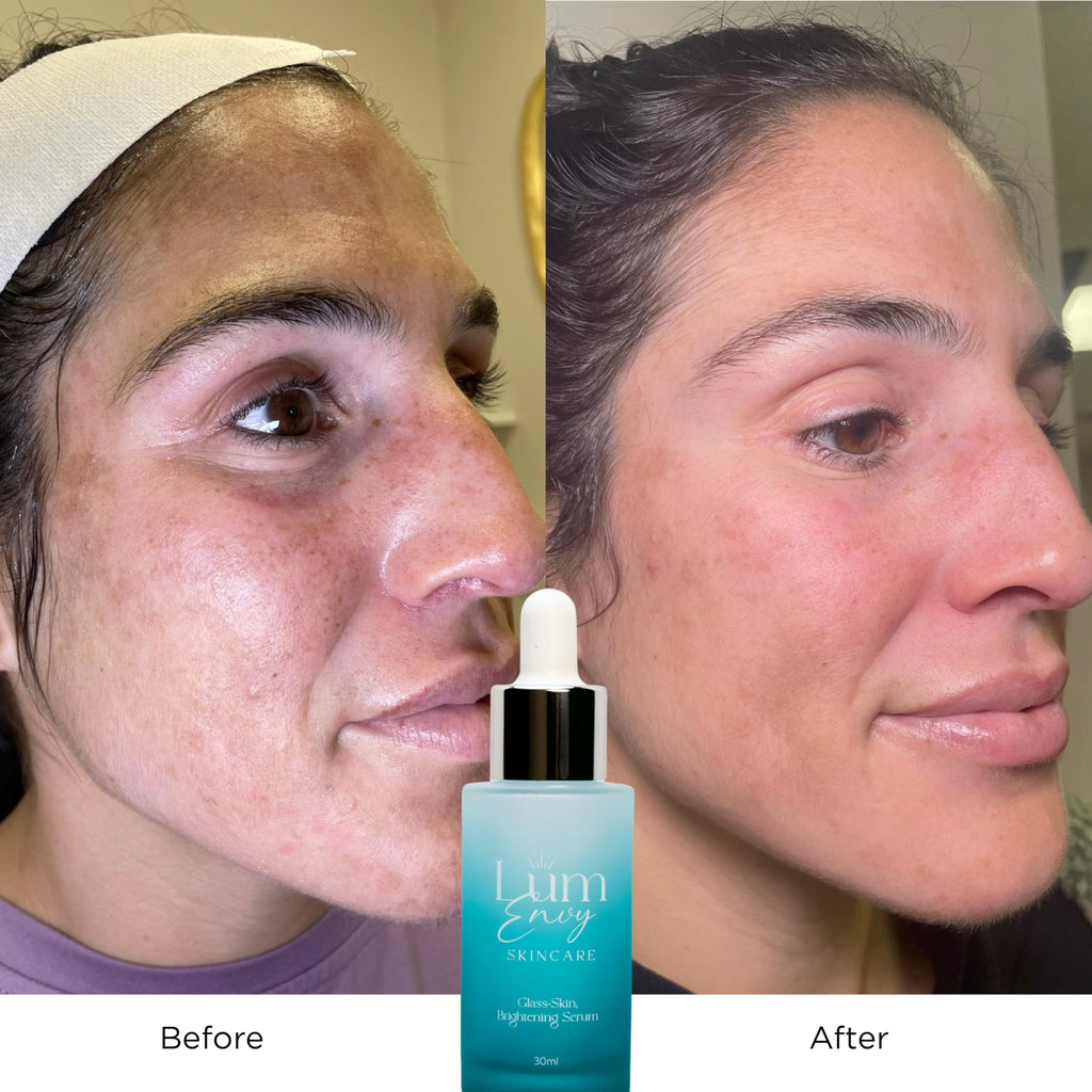 LumEnvy Salmon DNA Glass Skin Serum | Hydrating PDRN Niacinamide & Centella | 30ml