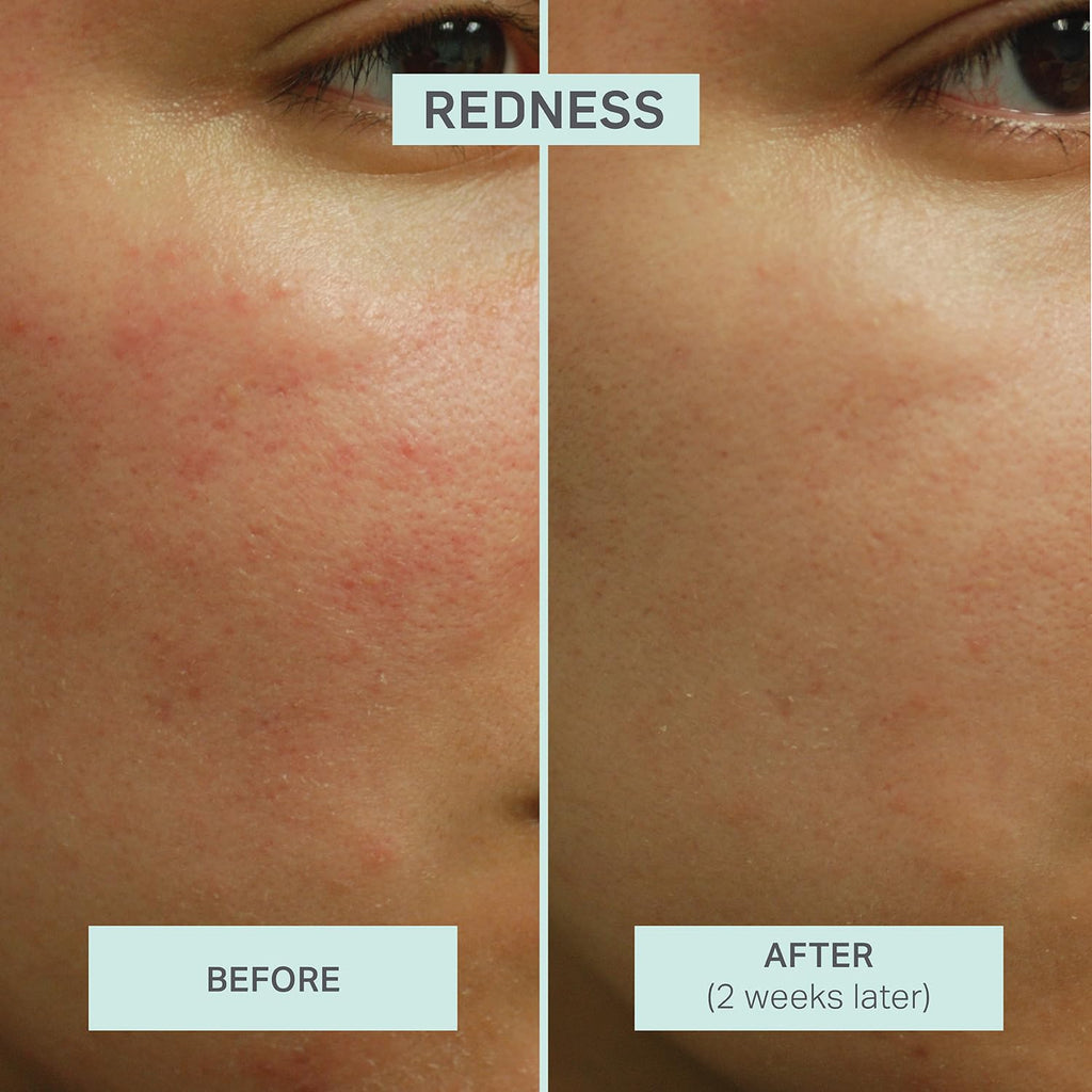 LUMION Save My Skin HOCl Serum – Calm, Balance & Clarity for All Skin Types