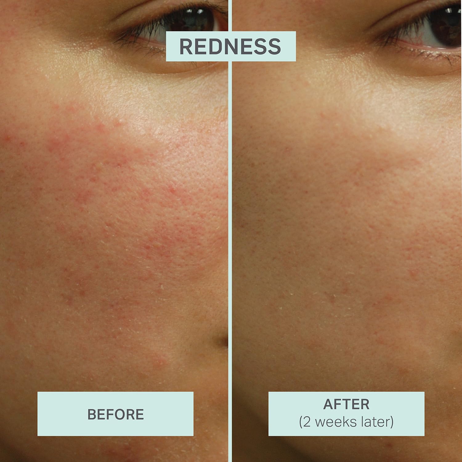 LUMION Save My Skin HOCl Serum – Calm, Balance & Clarity for All Skin Types