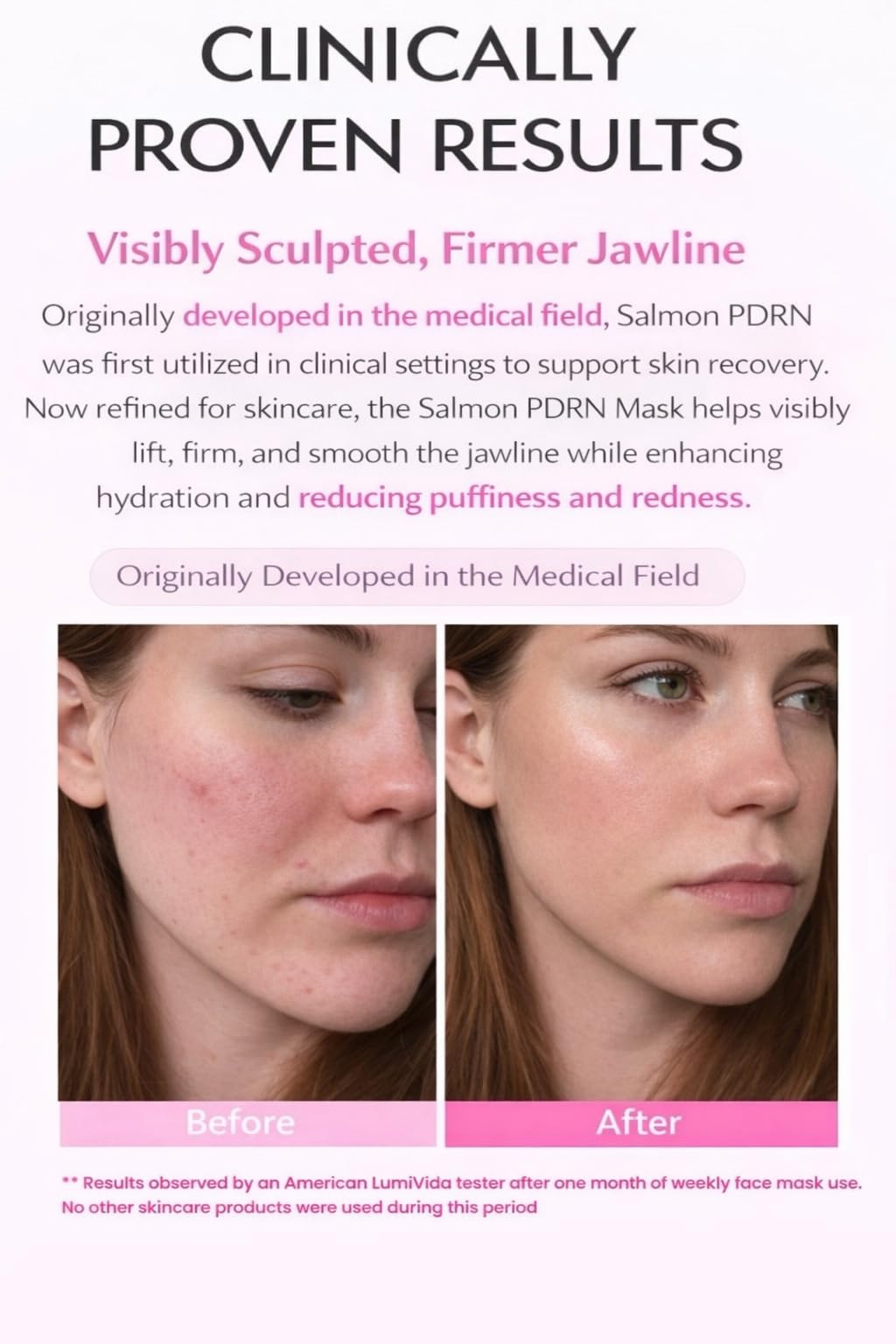 LumiVida Salmon DNA PDRN Jelly Gel Mask – Overnight Firming & Hydration (4 Pack) | K-Beauty with Niacinamide & Peptides