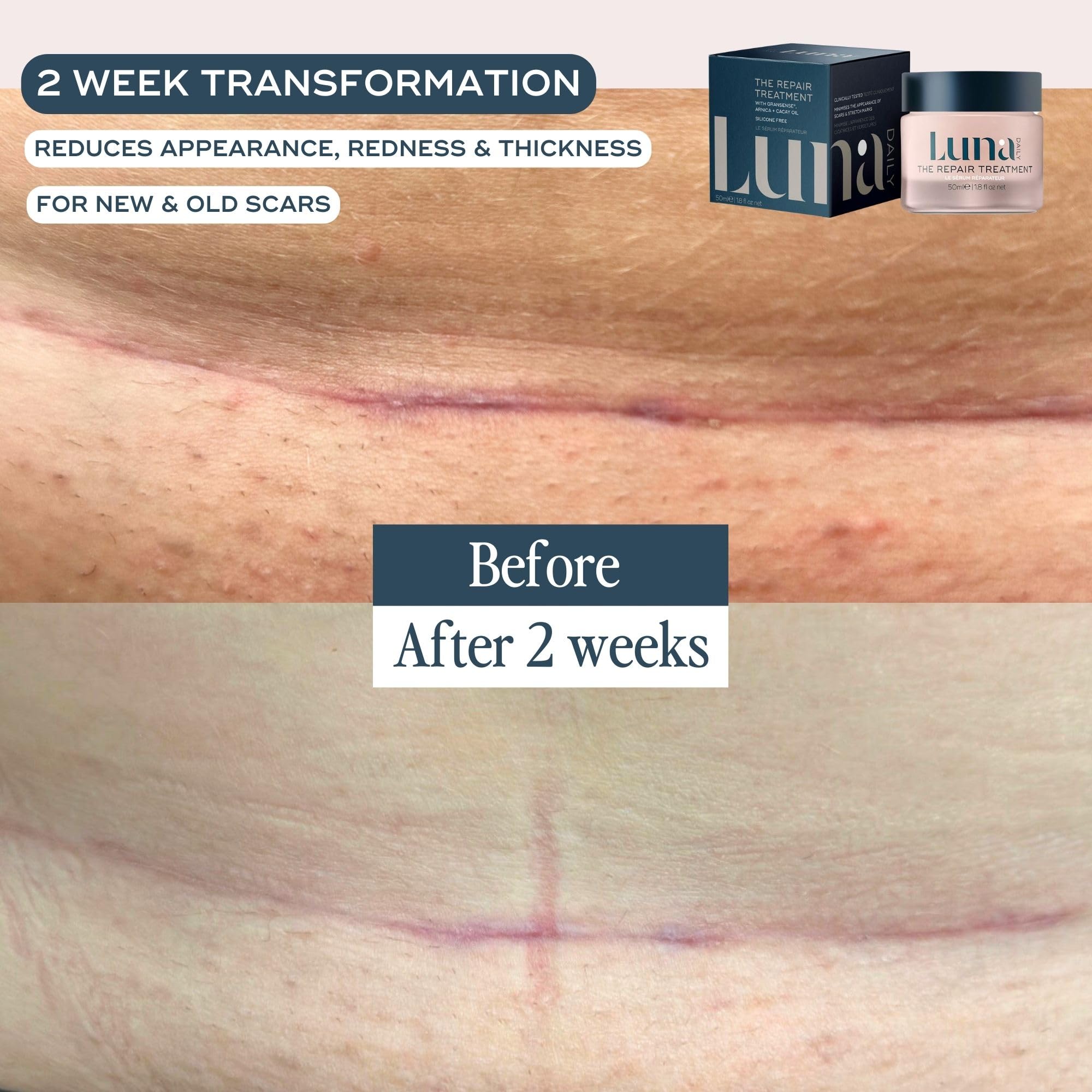 Luna Daily Stretch Mark & Scar Gel | Repair & Hydration with Arnica & Cacay Oil | 50ml