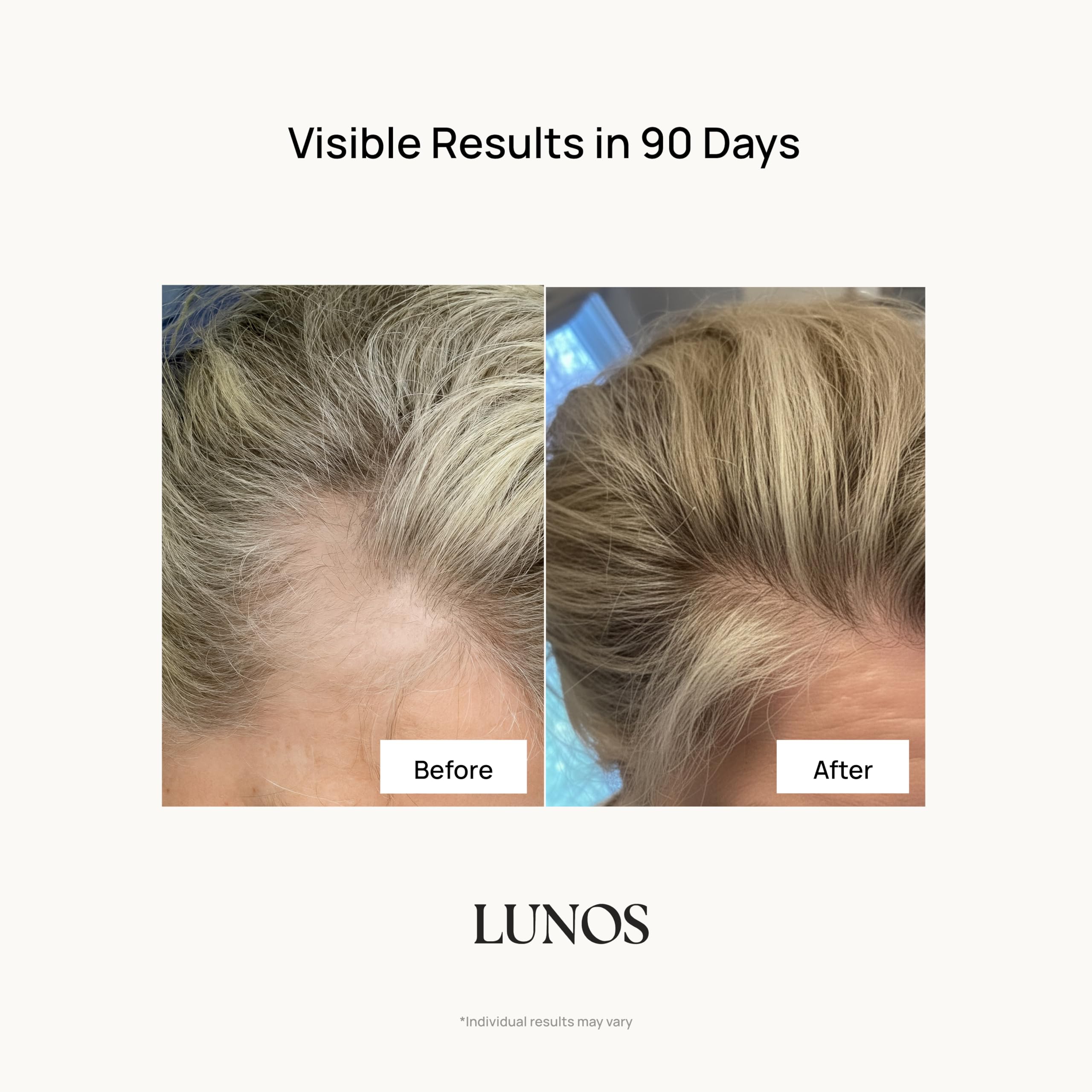 Lunos Grow Hair Growth Vitamins - 17-Ingredient Biotin, Saw Palmetto & Marine Collagen - 1 Month Supply