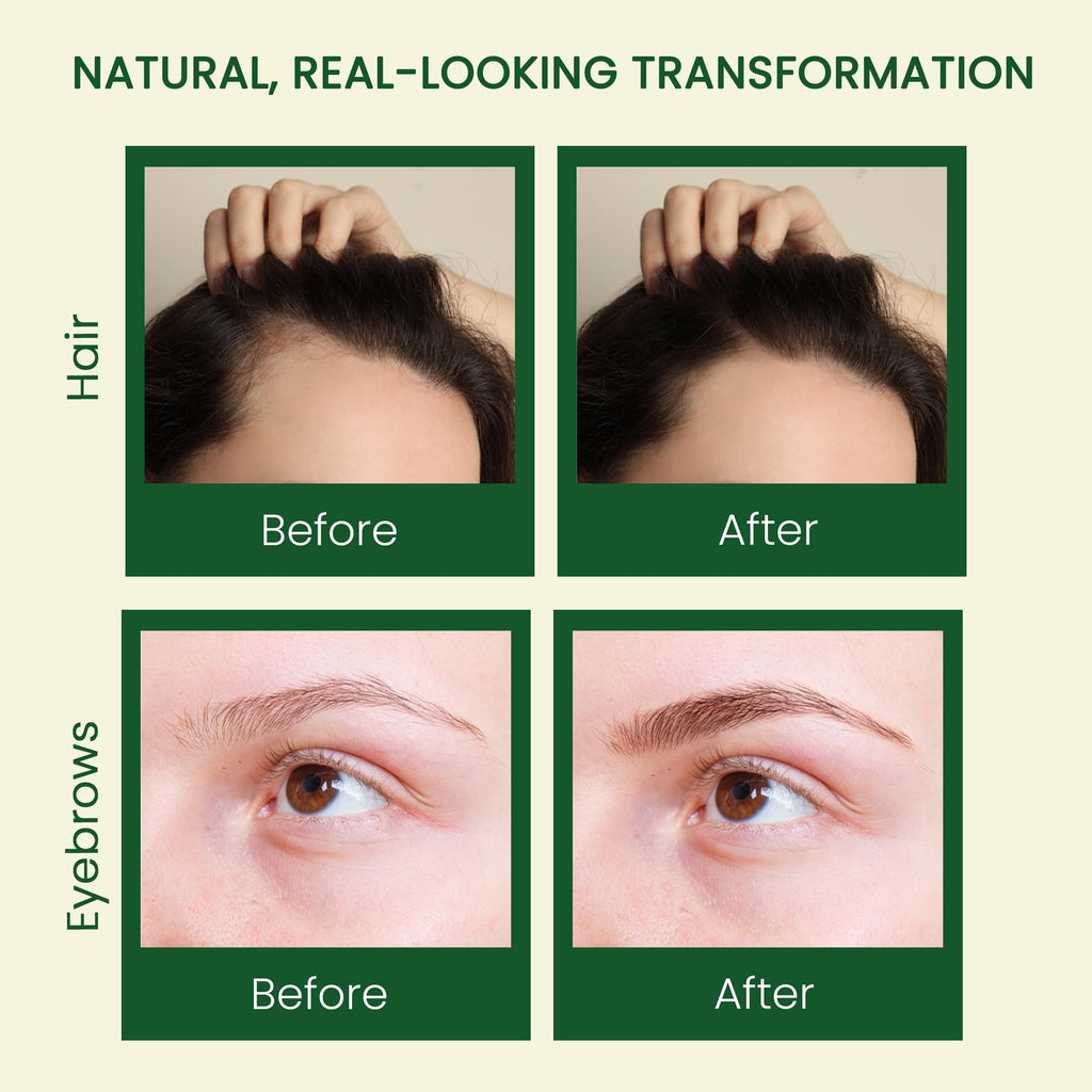 LuxoLook Pure Castor Oil – Cold-Pressed, Hexane-Free 100% Castor Oil for Hair, Skin, Lashes, Brows & Nails | Includes Dropper, Mascara Wand & Scalp Massager