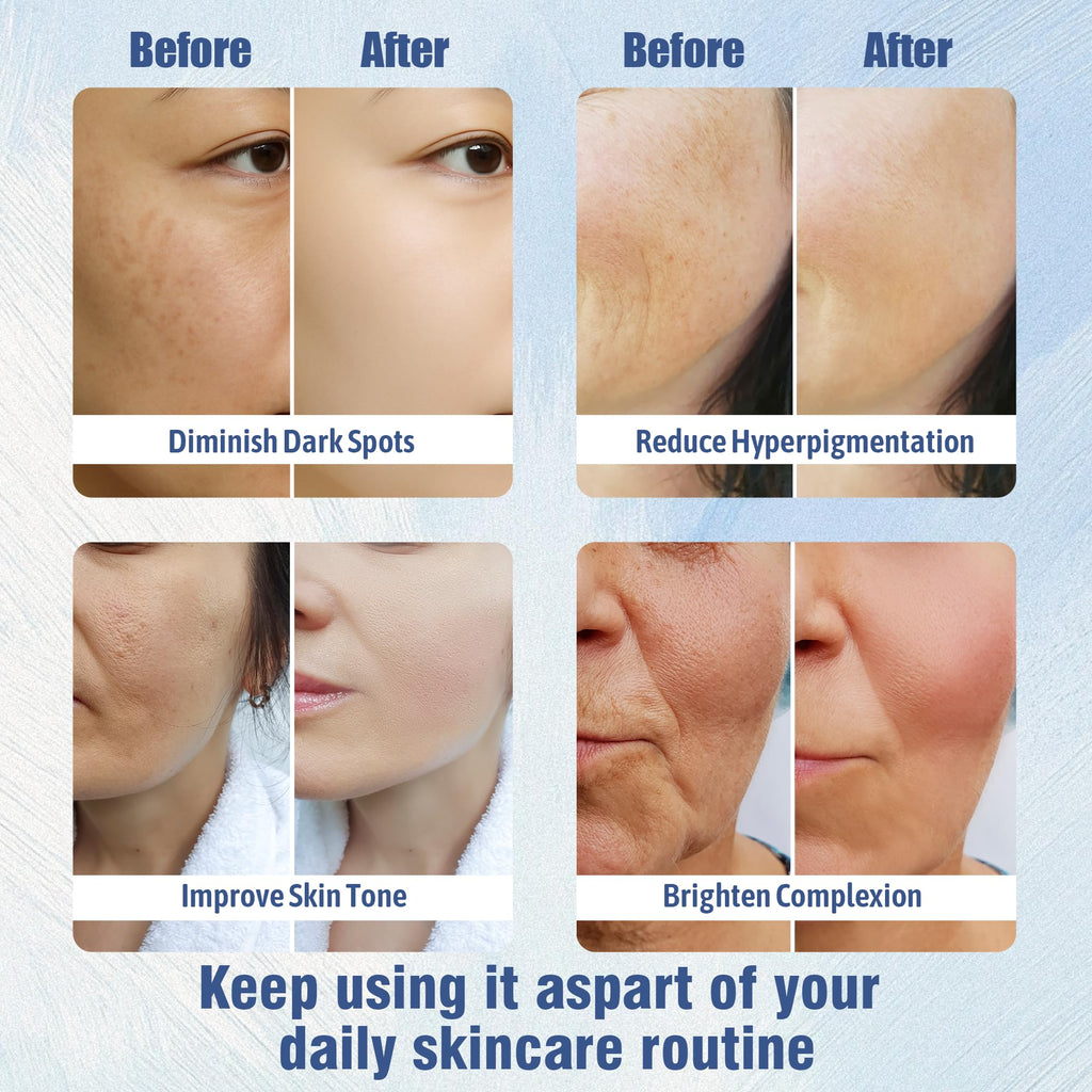 Luzia Glo Dark Spot Corrector – Brightening Face & Body Cream with Niacinamide, Tranexamic Acid & Alpha Arbutin