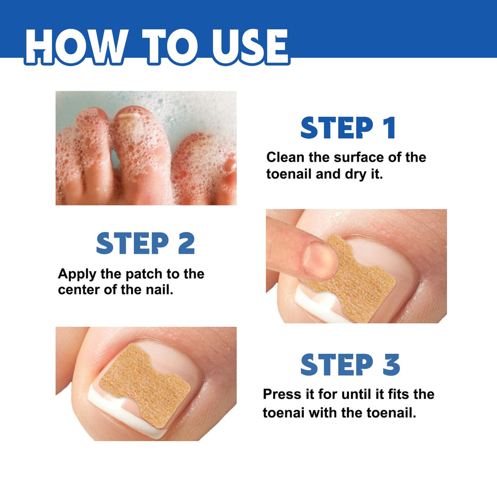 LYFXuGeMLM 20 Patches Fungal Nail Repair – Toenail Restoration, 8-Hour Intensive Treatment
