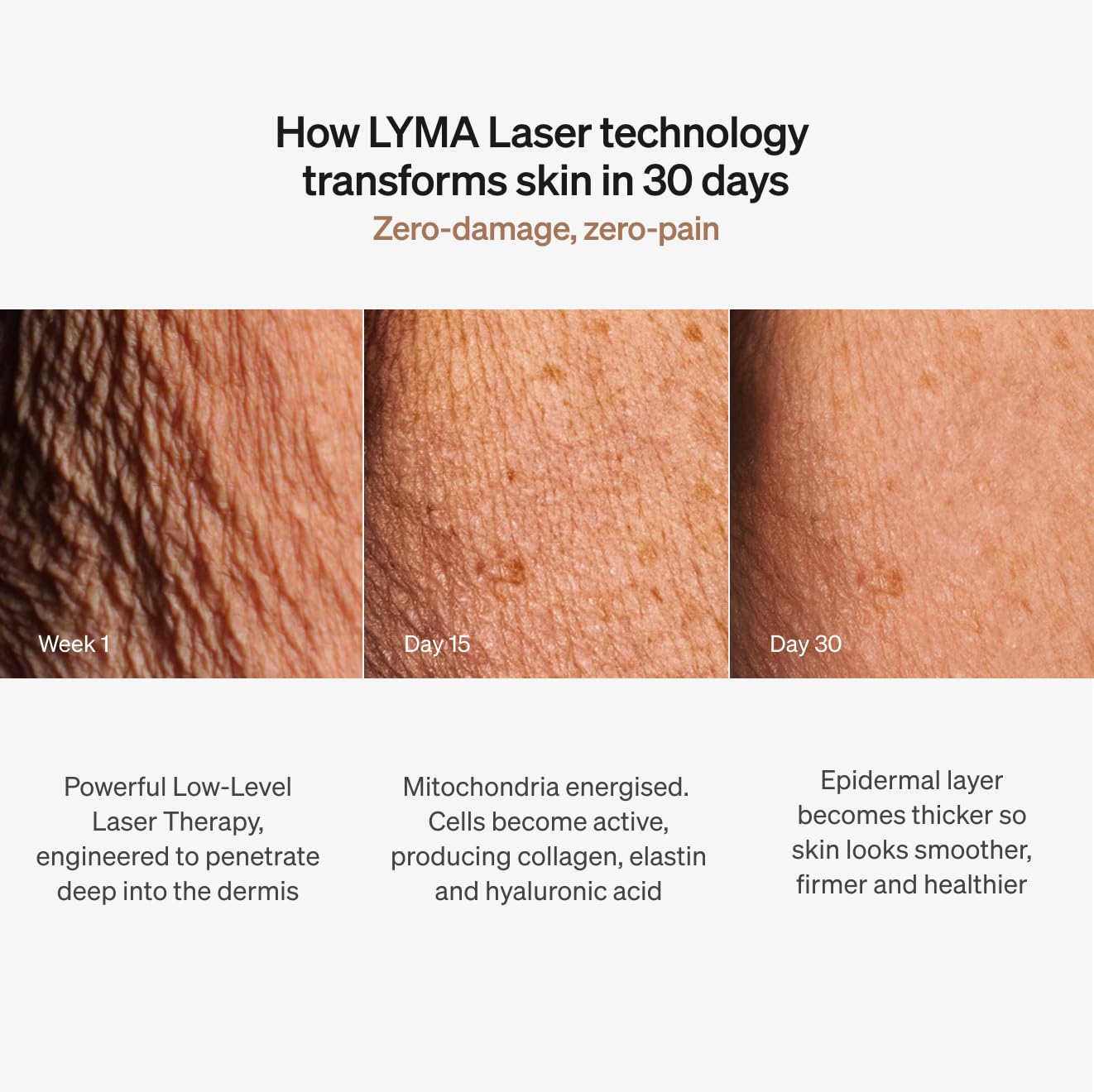 LYMA Laser Device – At-Home Clinic-Grade Near-Infrared Laser for Skin and Muscle Support