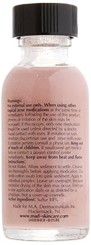 M.A.D Skincare Acne Drying Lotion – 10% Sulfur & Salicylic Acid | Overnight Spot Treatment | 1 fl oz