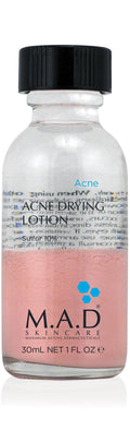 M.A.D Skincare Acne Drying Lotion – 10% Sulfur & Salicylic Acid | Overnight Spot Treatment | 1 fl oz