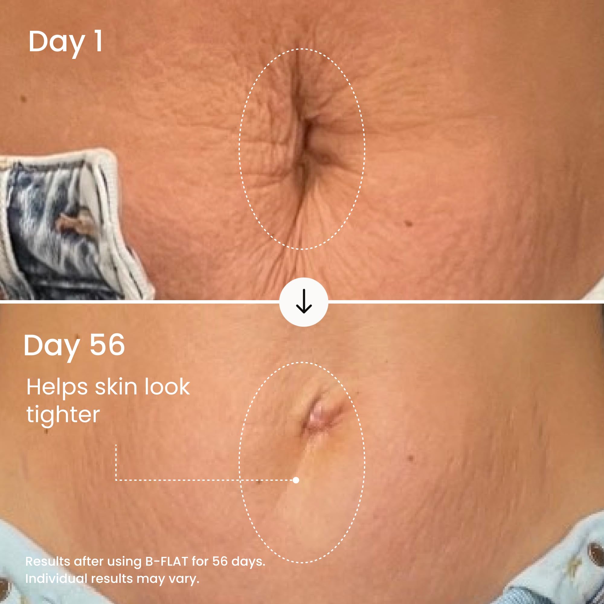 MAËLYS B-FLAT Belly Firming Cream - Postpartum Skin Tightening & Moisturizing (3.4 Fl Oz)