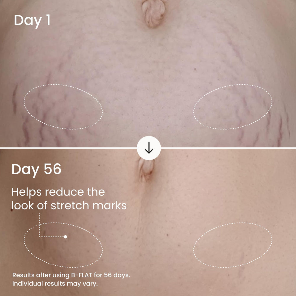 MAËLYS B-FLAT Belly Firming Cream - Postpartum Skin Tightening & Moisturizing (3.4 Fl Oz)