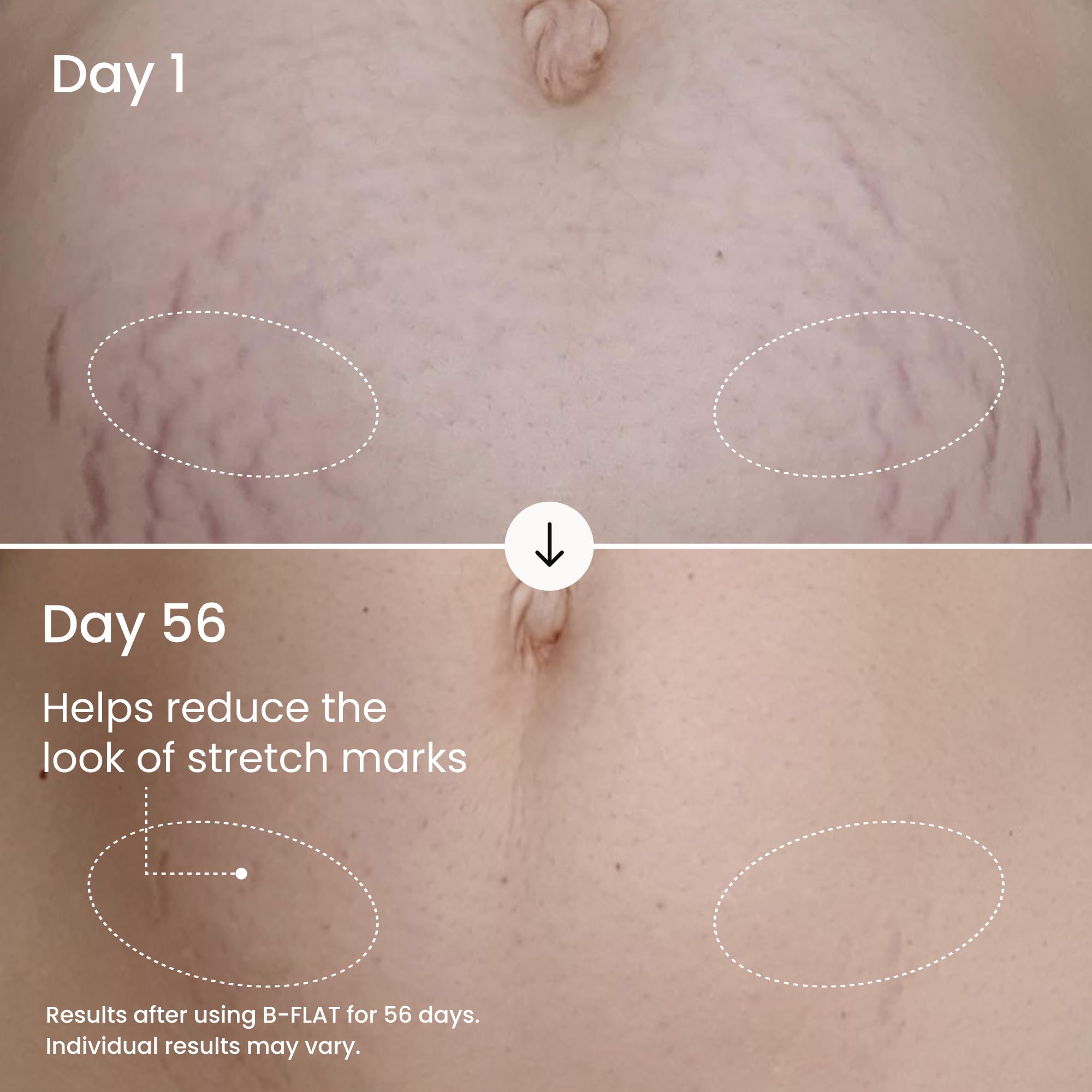 MAËLYS B-FLAT Belly Firming Cream - Postpartum Skin Tightening & Moisturizing (3.4 Fl Oz)