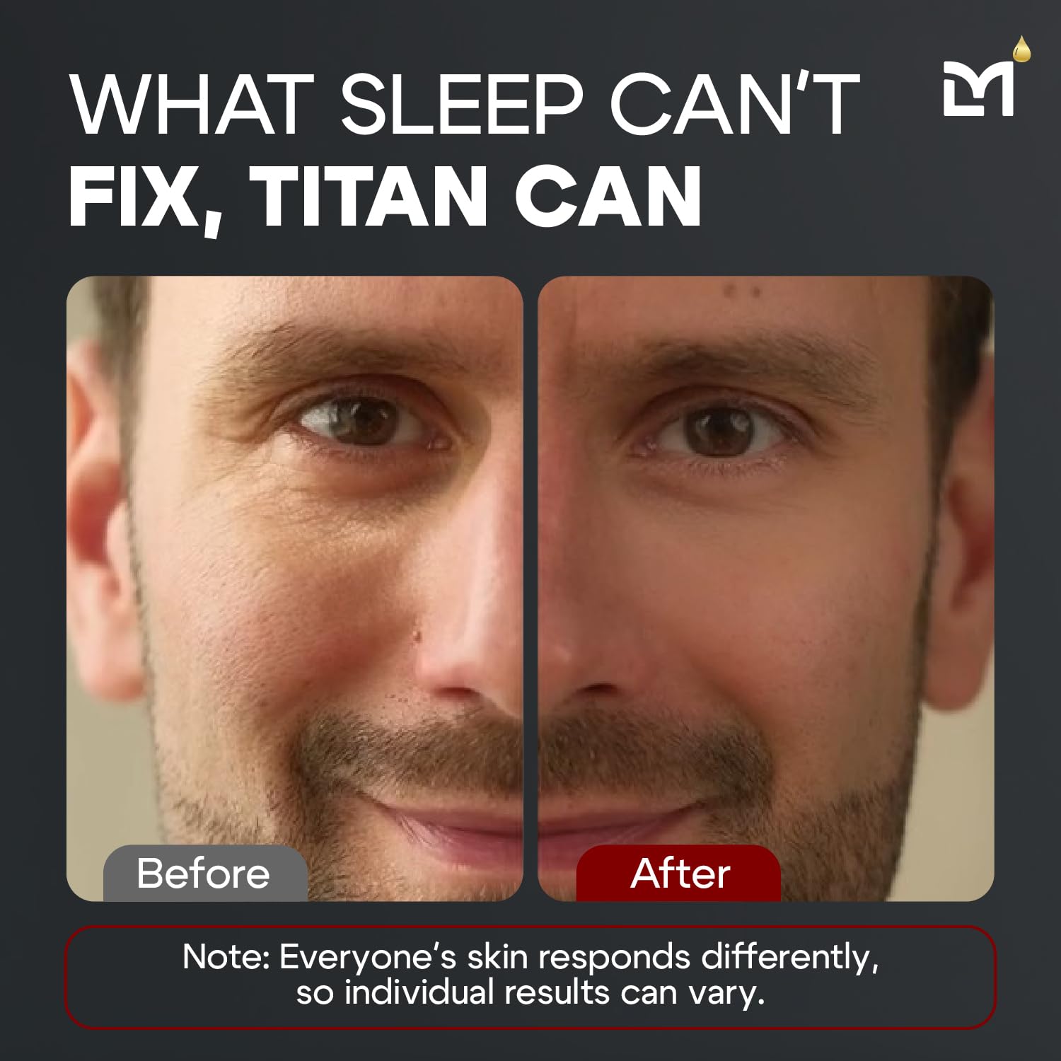 Man Labs Titan Eye Cream for Men – Anti-Aging, Dark Circles & Puffiness (Unscented)