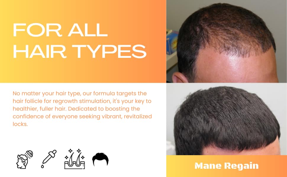 Mane Regain Minoxidil 5% Topical Solution for Men - Extra Strength, Unscented, 6 oz (3-Pack)