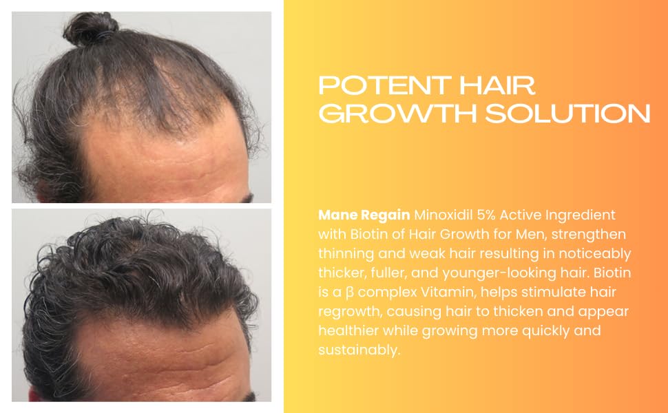Mane Regain Minoxidil 5% Topical Solution for Men - Extra Strength, Unscented, 6 oz (3-Pack)