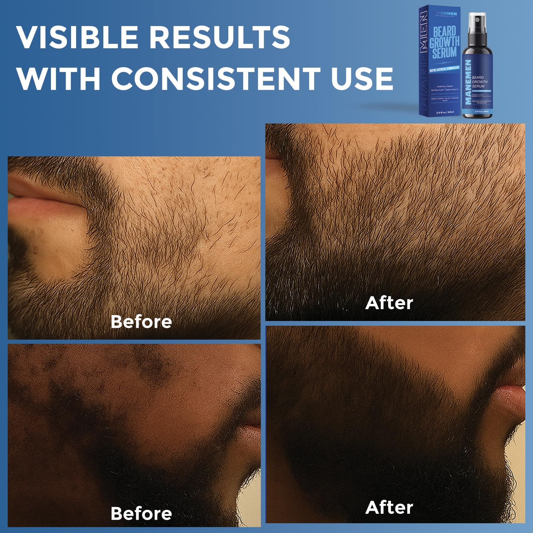 MANEMEN Beard Growth Serum Spray - Biotin, Castor Oil & Vitamins B5/B12
