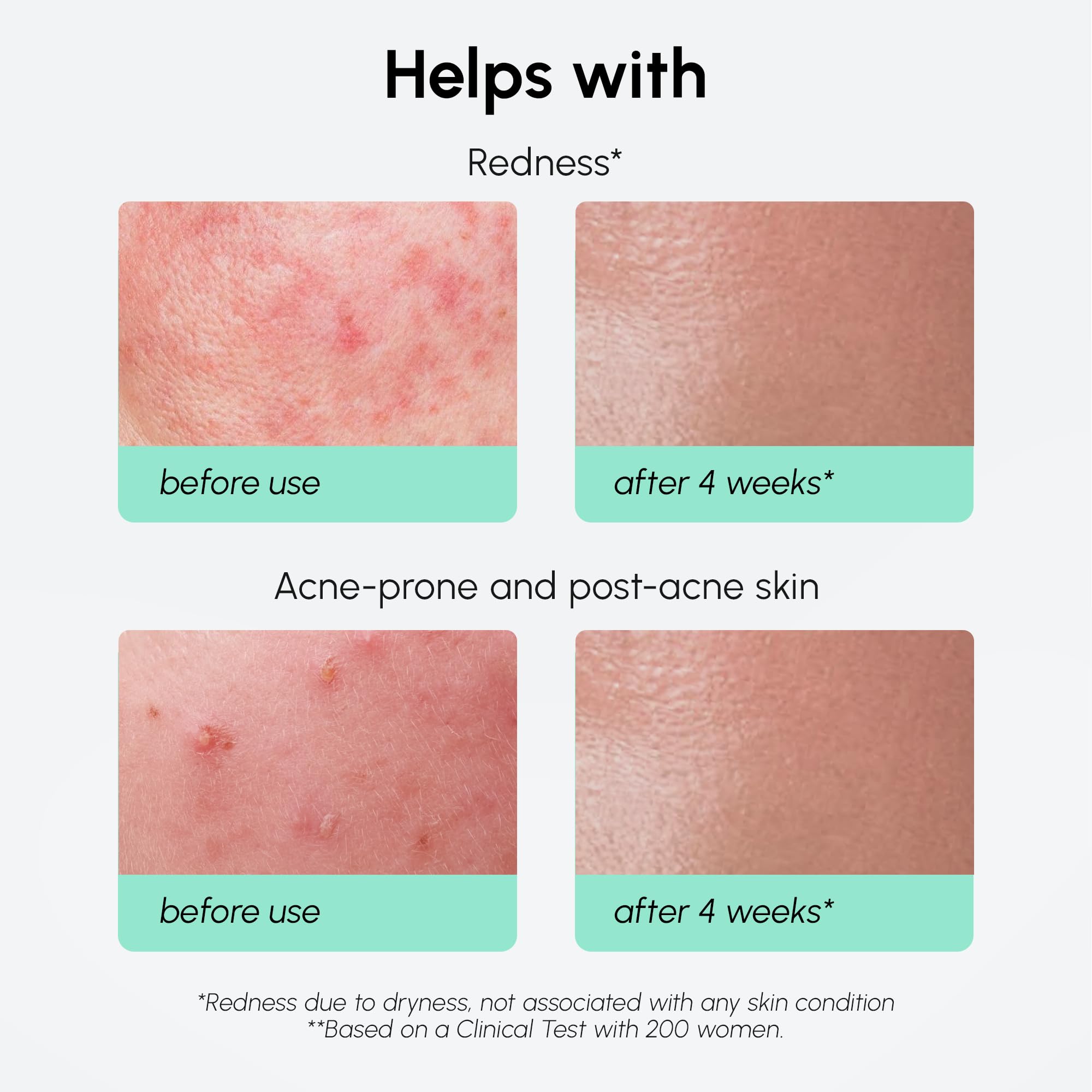 MAREE 10% Azelaic Acid Serum – Calming, Hydrating Face Serum with Niacinamide, Centella & Hyaluronic Acid