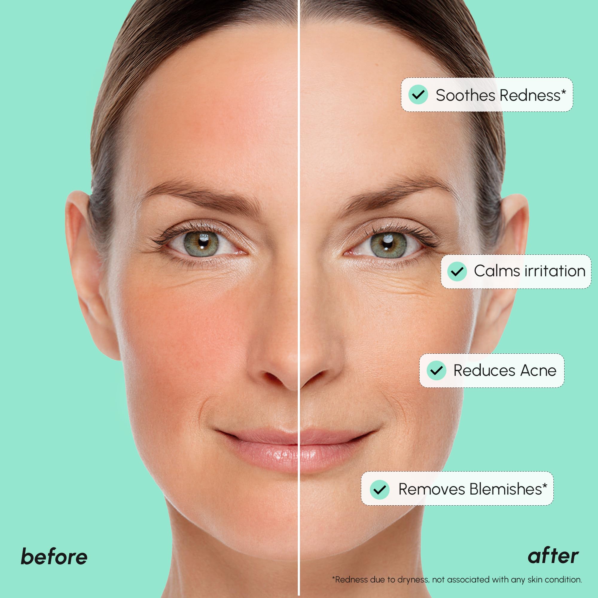 MAREE 10% Azelaic Acid Serum – Calming, Hydrating Face Serum with Niacinamide, Centella & Hyaluronic Acid