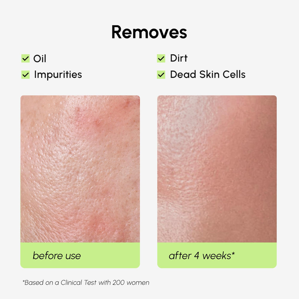 MAREE Exfoliating Toner with Salicylic Acid – AHA BHA Face Exfoliant & Pore Cleaner
