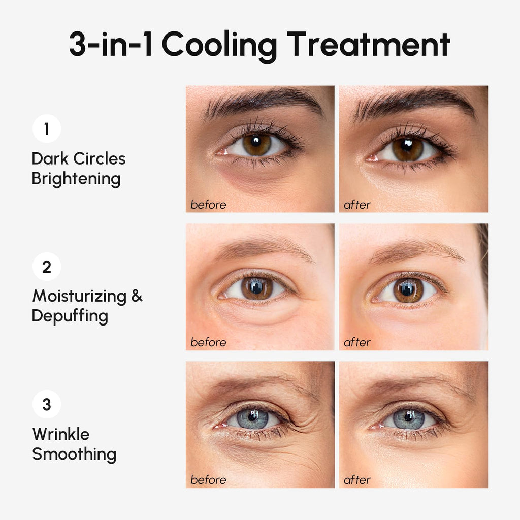 MAREE Eye Gels – Cooling Under-Eye Patches with Collagen & Hyaluronic Acid