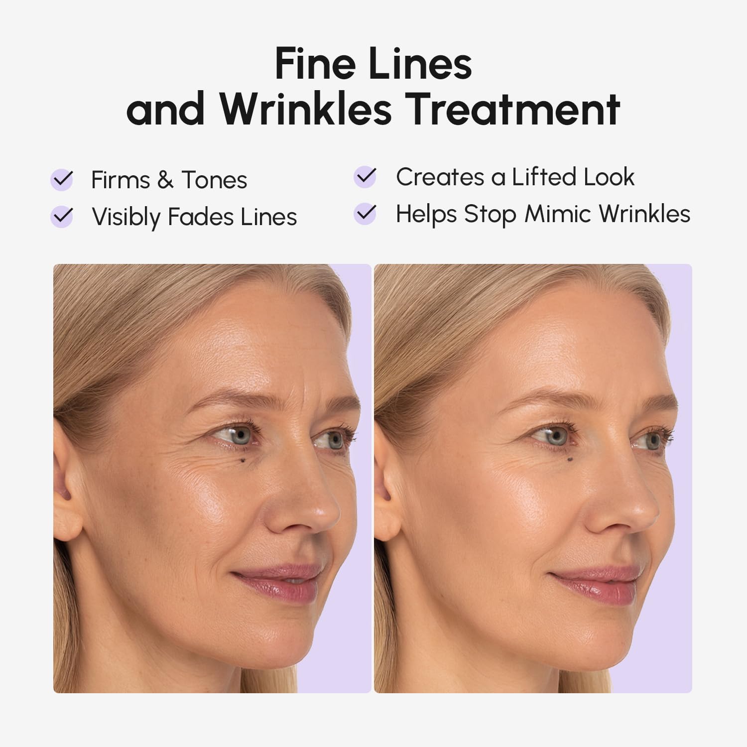 MAREE Face Lift Tape Wrinkle Patches – Overnight Patches for Eyes, Forehead & Neck | 224 Pcs