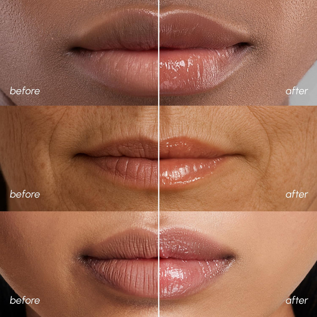 MAREE Lip Mask Overnight – Deep Hydration for Very Dry Lips | Hyaluronic Acid & Collagen