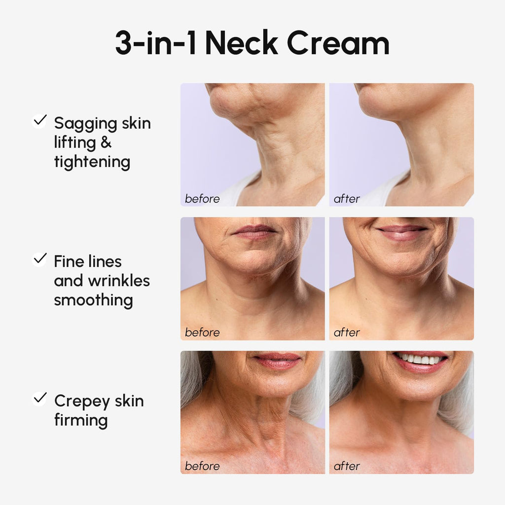 MAREE Neck Cream with Face Roller – Pro Retinol & AH-8 Firming Neck Cream