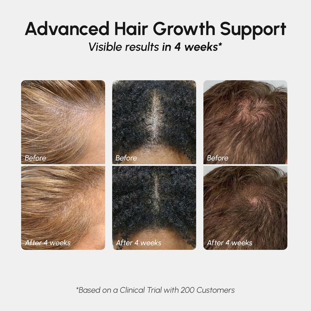 MAREE Hair Growth Spray – Caffeine, Rosemary & Castor Oil for Fuller-Looking Hair
