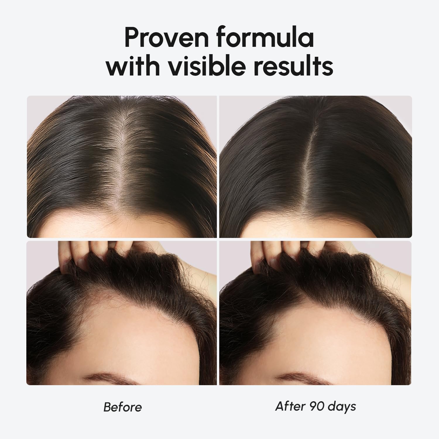 MAREE Hair Growth Serum – Caffeine Peptides, Castor & Rosemary Oil for Hair Growth