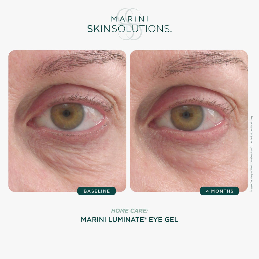 Marini SkinSolutions Luminate Eye Gel – Brighten Dark Circles & Smooth Eye Area