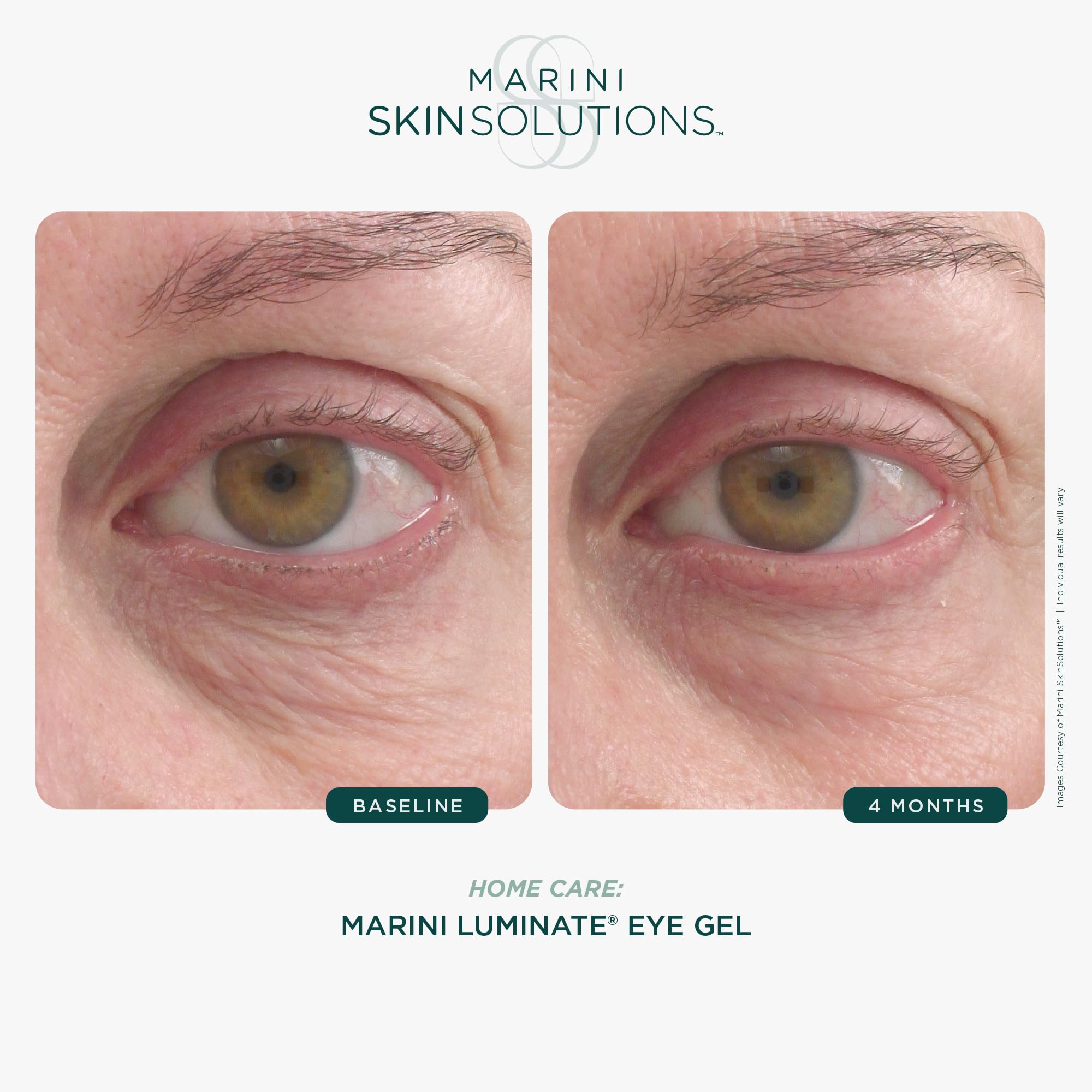 Marini SkinSolutions Luminate Eye Gel – Brighten Dark Circles & Smooth Eye Area