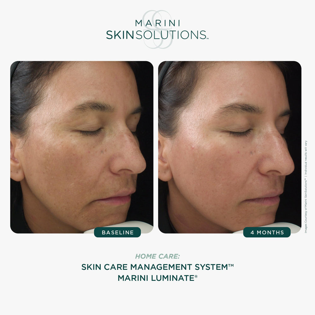 Marini SkinSolutions Luminate Face Lotion | Non-Hydroquinone Brightening + Anti-Aging, 1 oz
