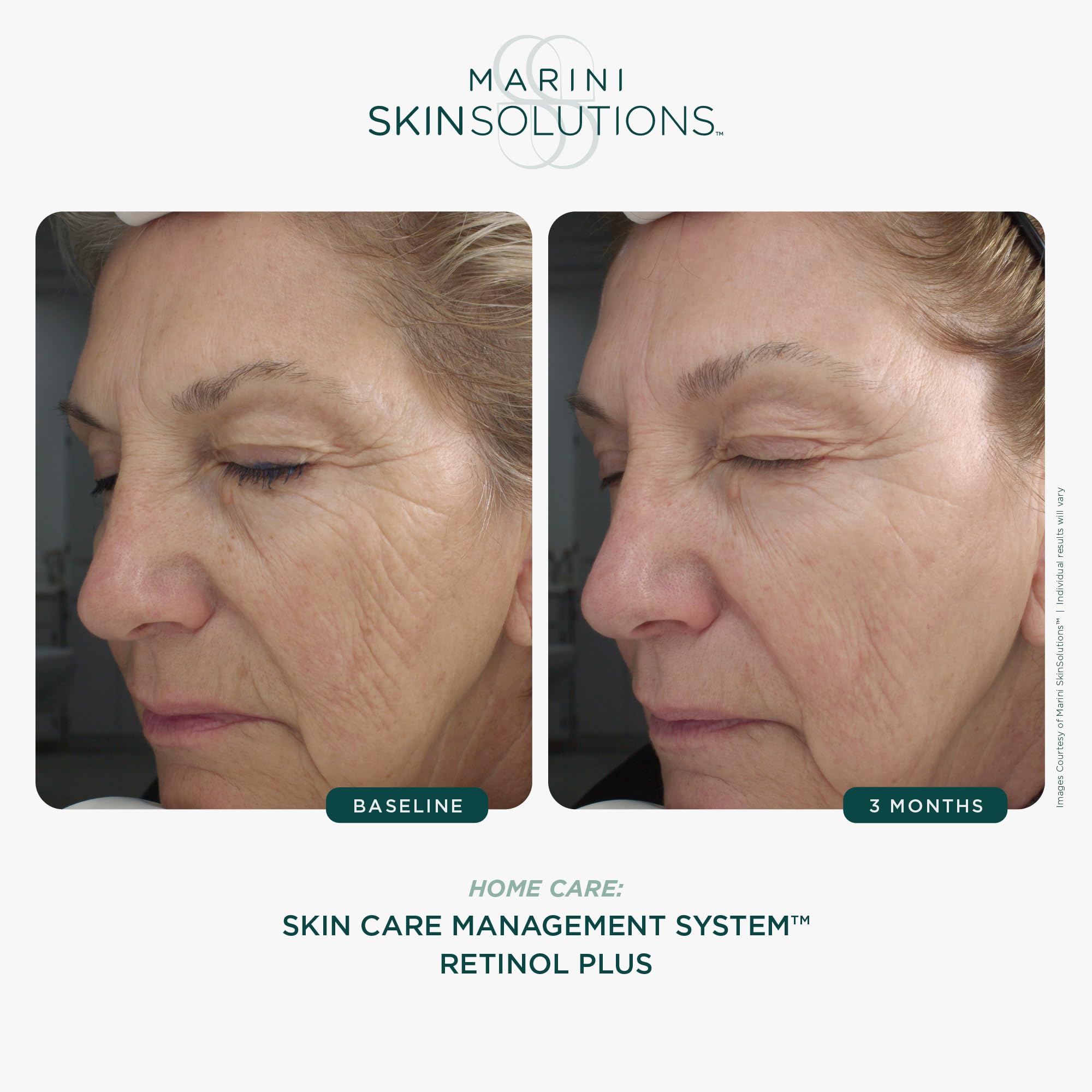 Marini SkinSolutions Retinol Plus – Anti-Aging Cream with Peptides, Antioxidants & Hyaluronic Acid (USA Made)