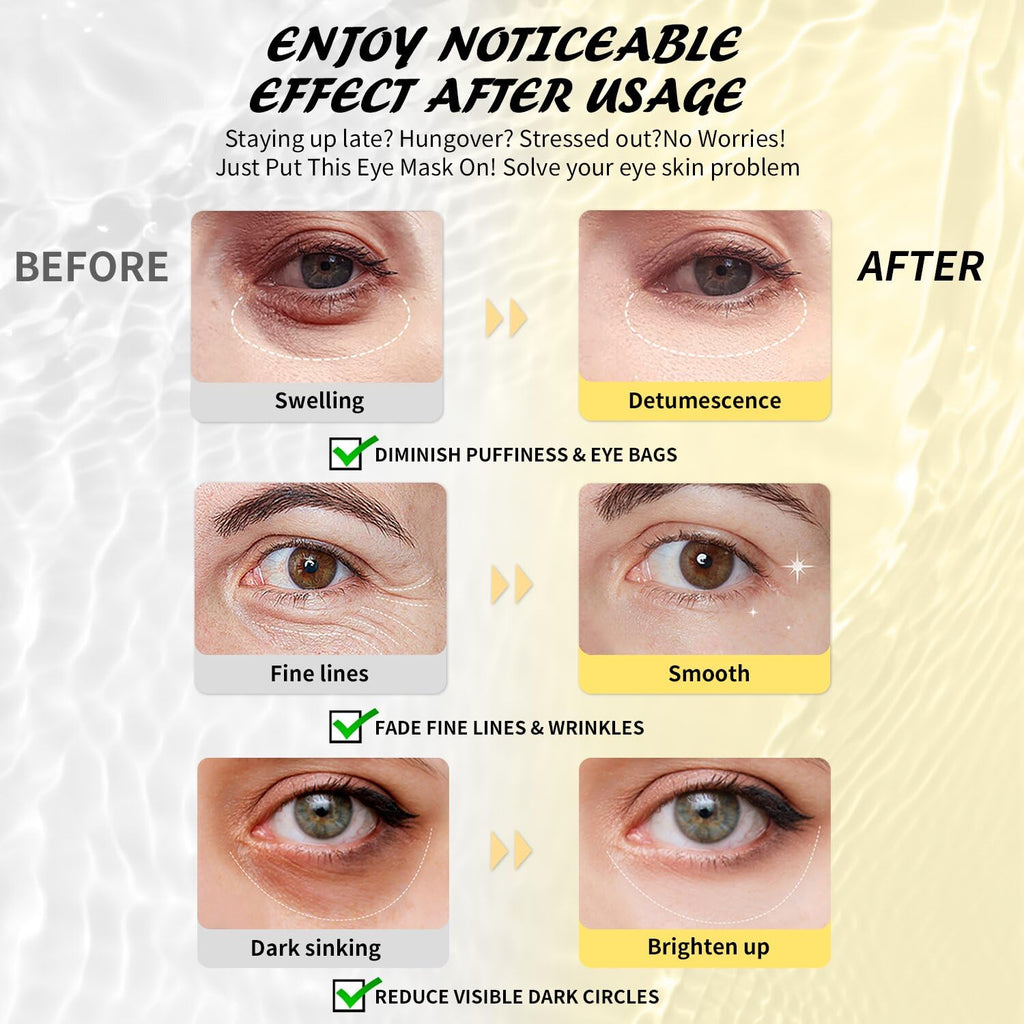 Maskiss Under Eye Patches Variety Pack (48 Pairs) – 8 Colors, 6 Pairs Each, Vegan Skincare Gift
