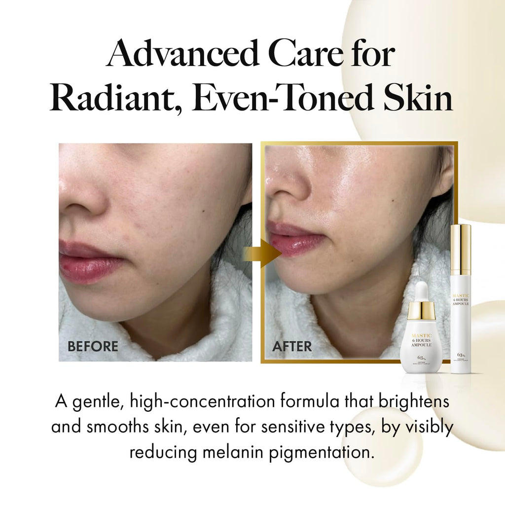 MASTINA Mastic Serum Roller – Dark Circle Remover & Eye Brightening Serum | White Mastic Complex 63% + Tranexamic Acid 2% + Niacinamide 5% (0.5 fl oz)