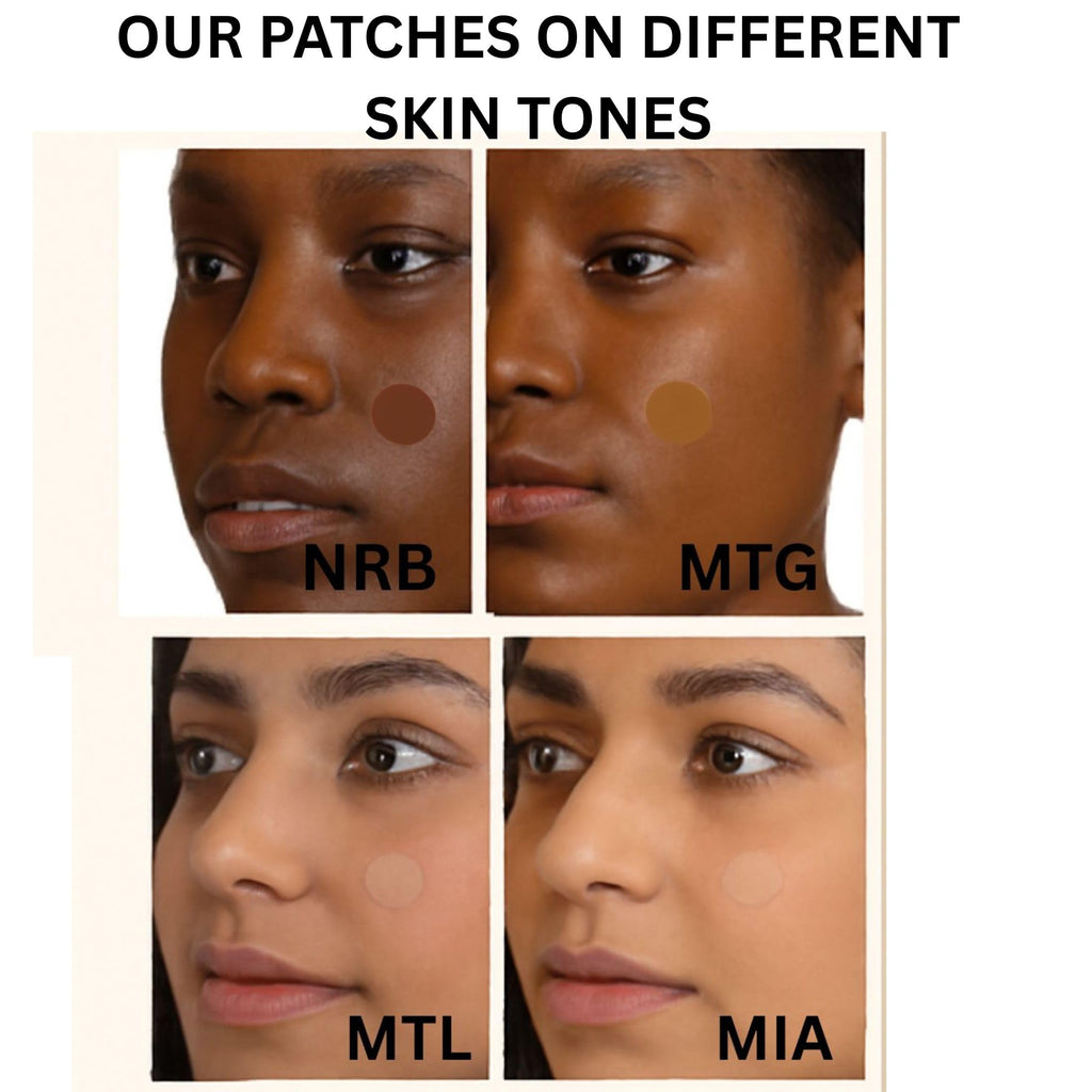 MATCHED Hydrocolloid Pimple Patches – Invisible, 3 Sizes, 72-Count – Skin-Tone Matching Acne Patches (Montreal)